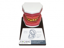 Демонстрационная модель "Ротовая полость курильщика" - «globural.ru» - Нижний Новгород