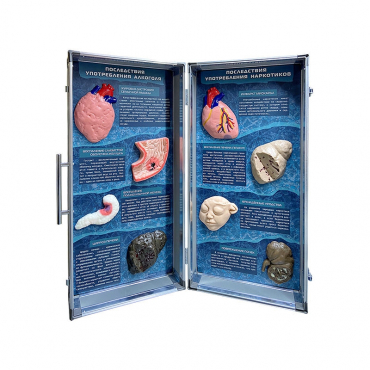 Учебно-демонстрационный кейс "Последствия употребления алкоголя и наркотиков" - «globural.ru» - Нижний Новгород